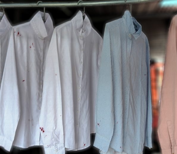 removing lipsticks stain