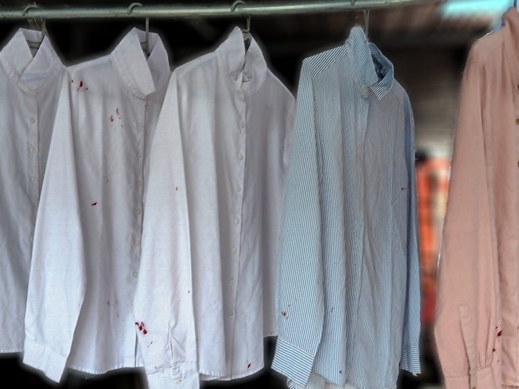 removing lipsticks stain